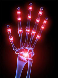 illustration of finger/wrist joints