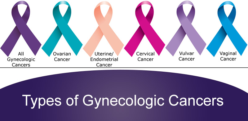 graphic of types of gynecologic cancers