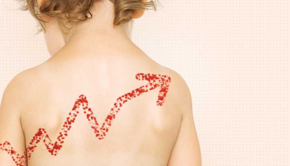 A photo of a child's back with a red arrow on it