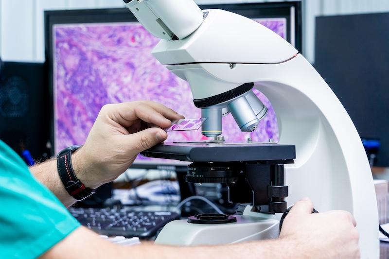 A hand places a slide on a microscope in front of a computer monitor