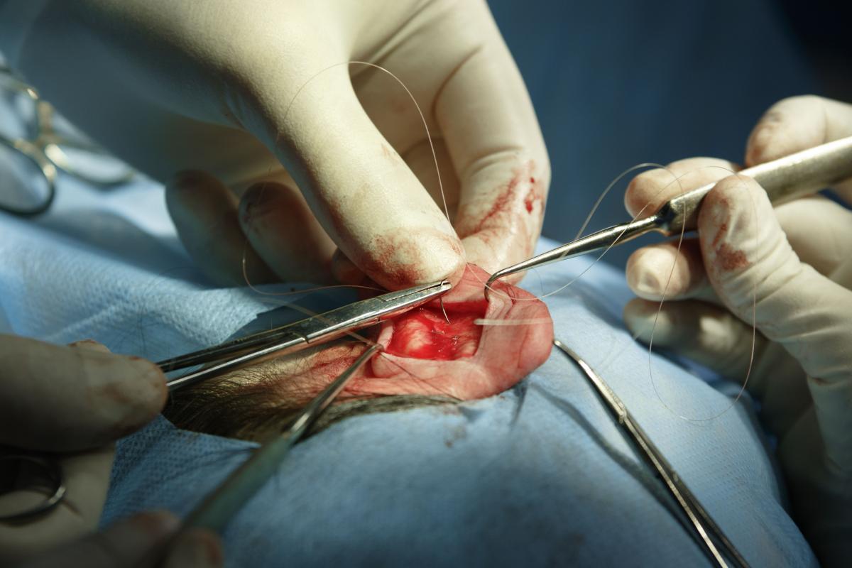 surgery being performed on an ear