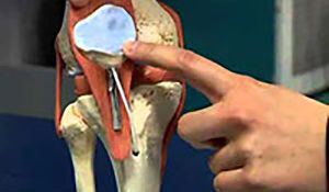cross-section of knee joint