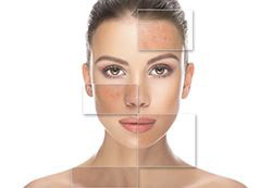 clear vs. acne skin