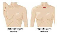 surgery procedure illustration