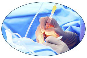 surgery procedure oval