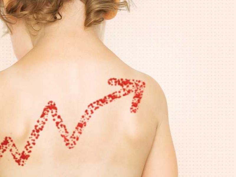 A photo of a child's back with a red arrow on it