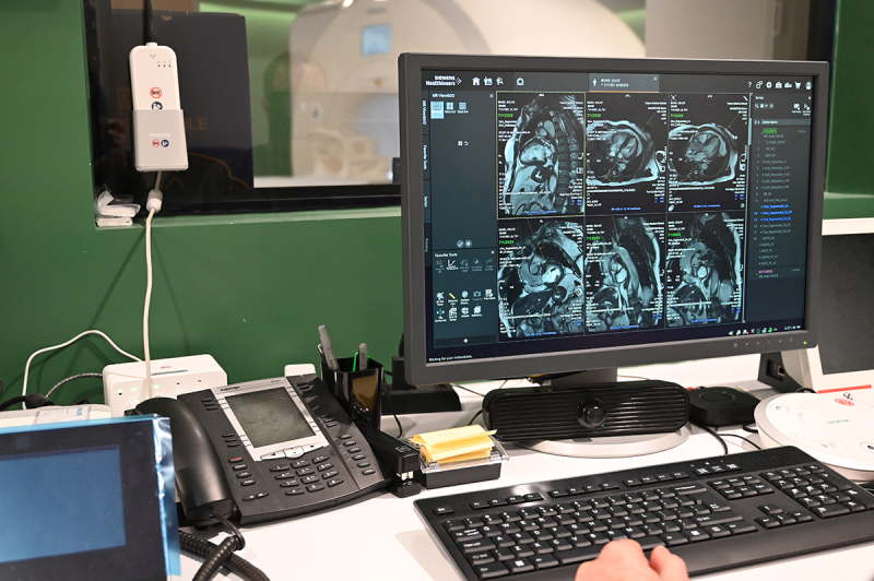 a computer with MRI scans on a spine and other body parts