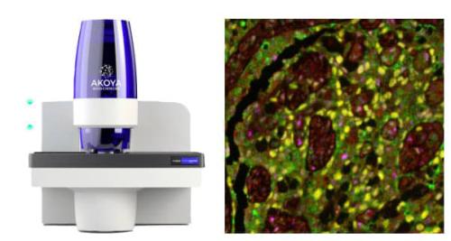 Akoya Phenolmager Fusion Slide Scanner