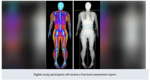 LA Osteoporosis Study LA Osteoporosis Study