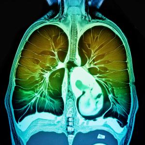 This is an AI generated image of a lung MRI