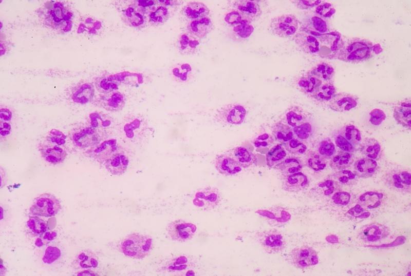 a photo of pink looking cells identified as sepsis